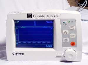 Vigileo Monitor